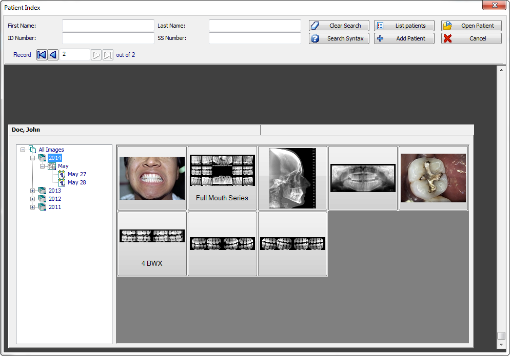 Apteryx XrayVision Full Latest Version Apteryx XrayVision Full Latest Version